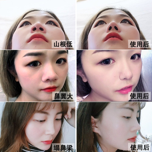 【小红书推荐 美鼻神器】告别丑鼻子精油变高山根鼻梁精华液挺鼻 - 图1