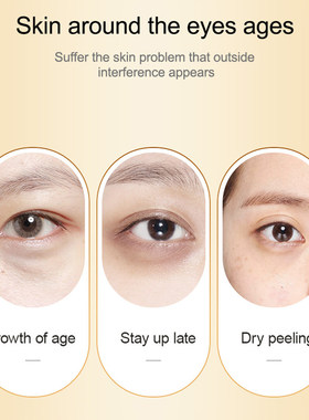 Anti-rugas Eye Cream, remover sacos de olho, olhos inchados,