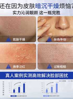 氨甲环酸精华液传明酸湿敷淡斑