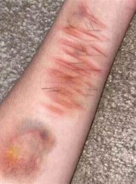小刀疤淤青伤口纹身贴 擦伤割伤受伤万圣节纹身贴仿真割腕恐怖