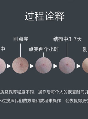 汗管瘤眼部去除神器无痛不留日本