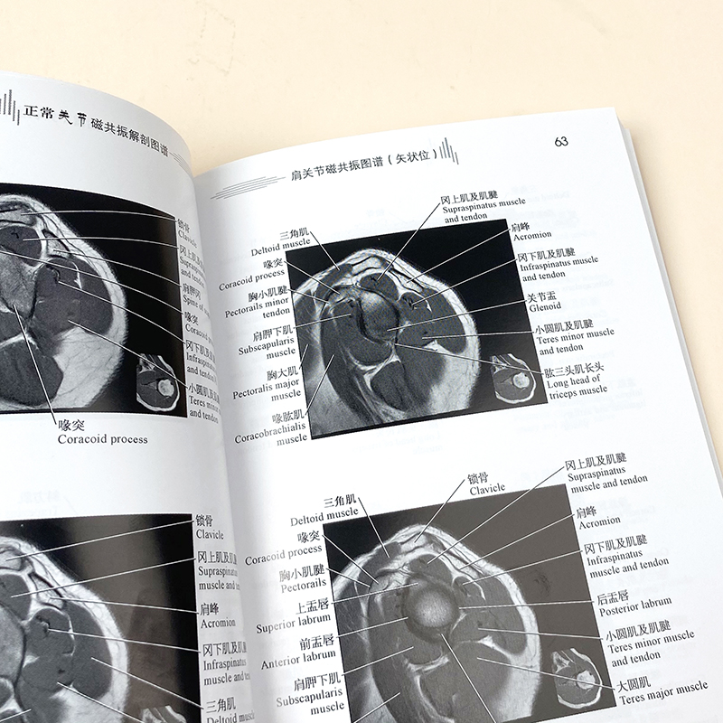 正常关节磁共振解剖图谱李明华医学影像学高清解剖图谱丛书供医学生影像科医师及临床医师骨科医师等MRI解剖参考工具用书-图2