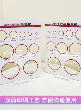 妇产科室摆台宫口扩张示意图