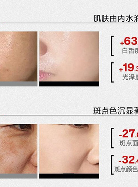 雅屏左旋维C固态精华片VC冻干粉