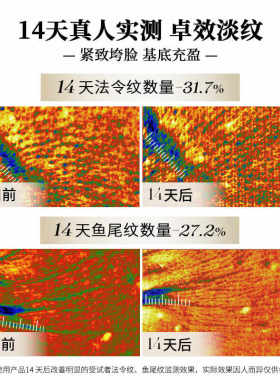 【买1套送1套】百雀羚抗衰老套装