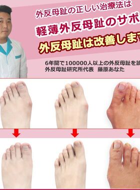 日本超薄款拇指外翻脚趾矫正器男女大脚骨外翻纠正脚趾分趾器