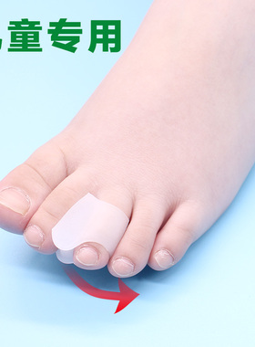 儿童脚趾矫正器重叠指宝宝中指脚趾头弯曲爪状趾婴幼儿纠正分趾器