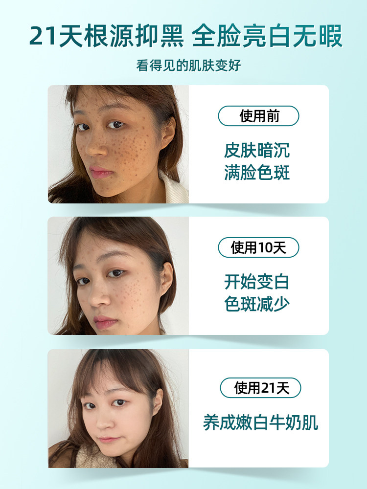 烟酰胺10%美白淡斑精华去黄原液 水木花草液态精华