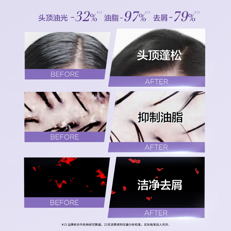 欧莱雅大金瓶精油女无硅油洗头水 欧莱雅美发洗发水