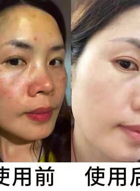袪黑色素斑点控色提亮肤色精华油