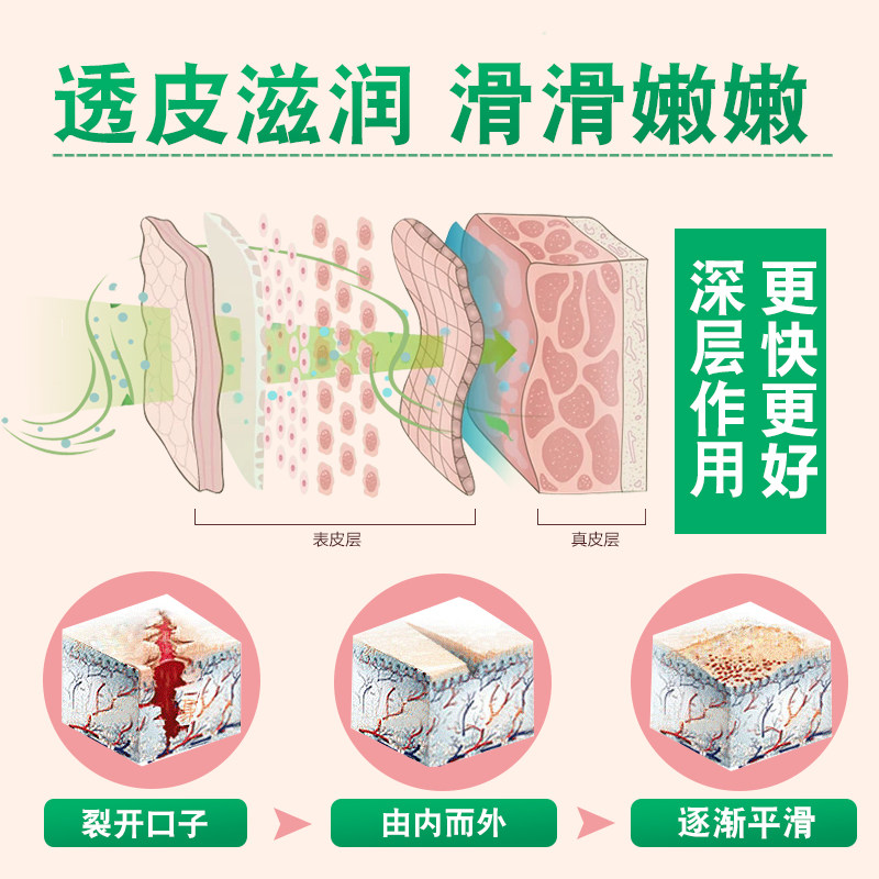 脚后跟干裂龟裂皮肤护手修复霜 金泰康铃医护手霜