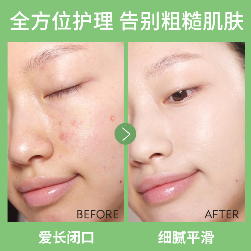 snoopy学生青少年护肤品套装女 snoopy化妆品面部护理套装