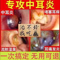Treatment for otitis ear drops Ear Fluid People Medication Cream can be removed with root ear itching abscess Pussy Inflammation Anti-inflammatory Special Medicine