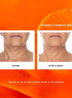 美国直邮Naturium Vitamin C Complex Face Serum维生素C面部精华