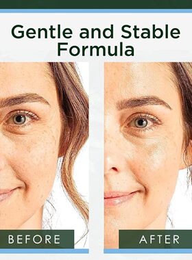 美国直邮Tree of Life Hyaluronic Acid Serum透明质酸补水精华