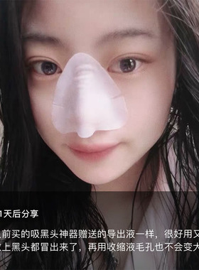韩纪黑头导出液美容院专用
