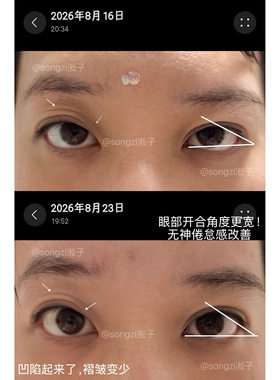意大利Mycli反重力眼霜2.0新版