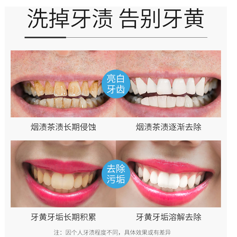 扬美旗舰店扬美洁牙慕斯泡沫牙膏去口臭去黄牙垢亮白清新口气美白去牙渍结石1