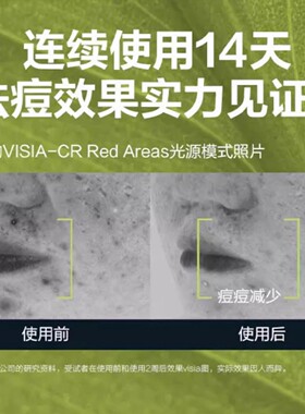 曼秀雷敦男士洗面奶控油抗痘清爽