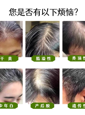 侧柏叶精油乌发固发植物护发防脱