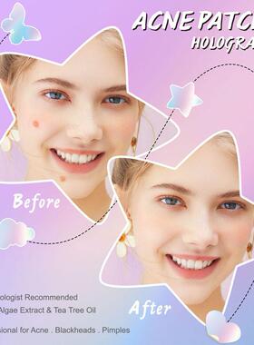 Invisible Acne Patches Removal Pimple Anti-Acne Hydrocolloid
