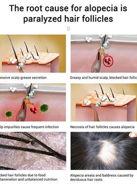 Hair Growth Oil Fast Hair Growth Products Scalp Treatments P