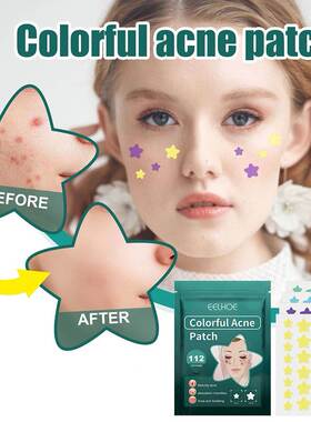 112pcs Pimple Patches Fade Face Spot Repair Star Shaped Pimp