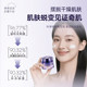 Runchuyan Blue Copper Peptide Cream ສ້ອມແປງຜິວຫນັງທີ່ລະອຽດອ່ອນ