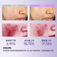 Runchuyan Blue Copper Peptide Repair Lotion ຄວບຄຸມຜິວ