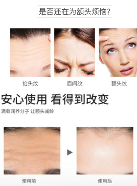 抗皱川字纹贴官方店防皱纹贴