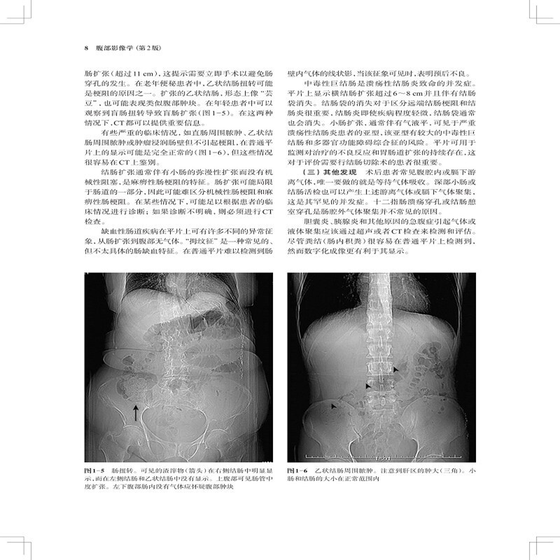 正版腹部影像学第2版影像学大师系列腹部CT诊断学放射影像系列相关医学影像学书籍胸部影像学上海科学技术出版社9787547851319 - 图3