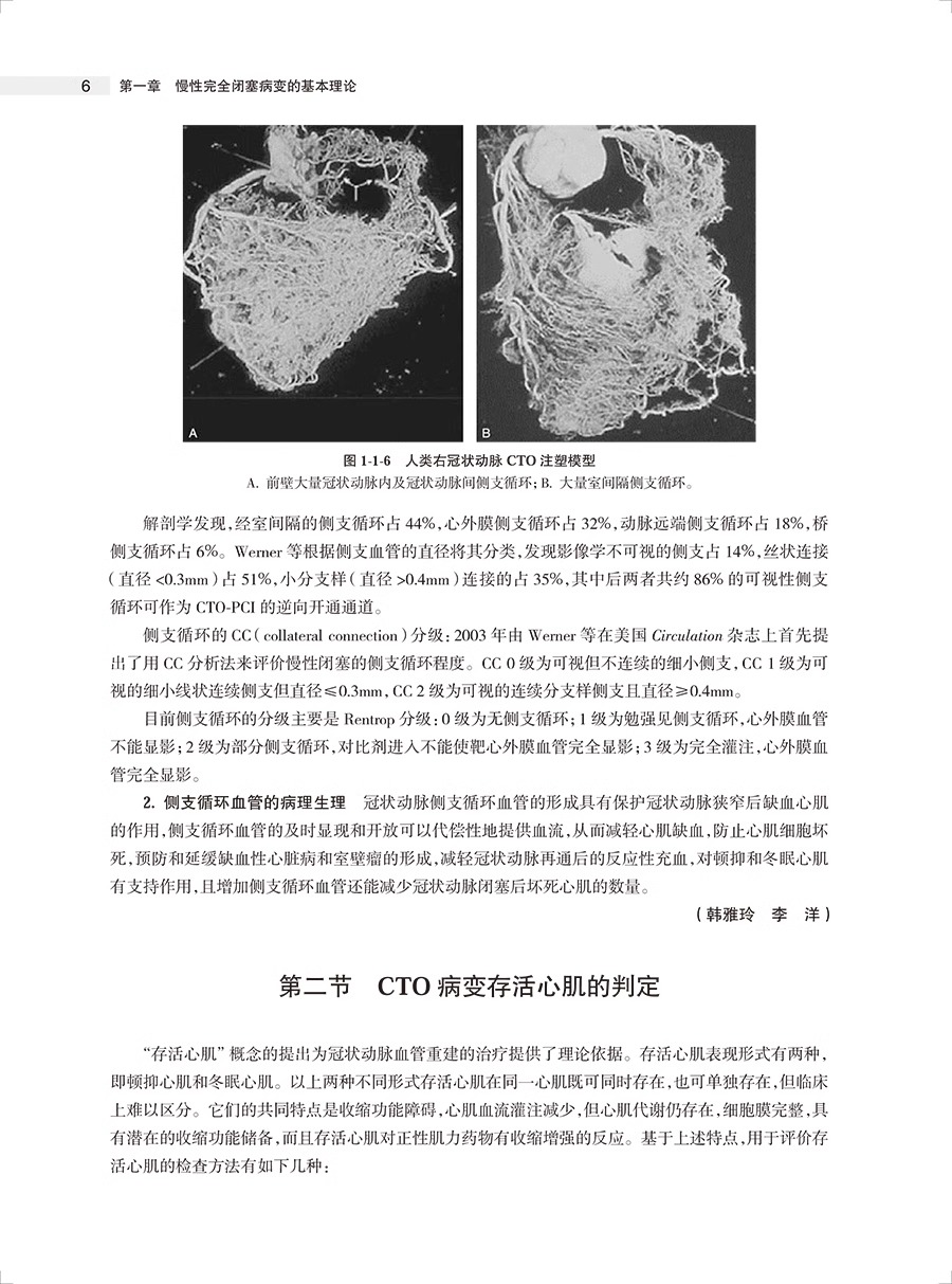 攻克CTO慢性完全闭塞冠状动脉病变介入治疗第2版第二版荆全民陈纪言陈绍良主编人民卫生出版社 9787117348379医学卫生-图2