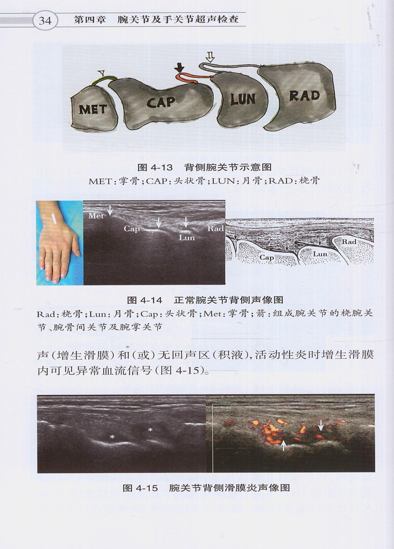 正版中国肌骨超声检查指南中国医师协会超声医师分会指南丛书人民卫生出版社超声诊断学超声医学书籍医学影像学可搭配奈特断层-图0