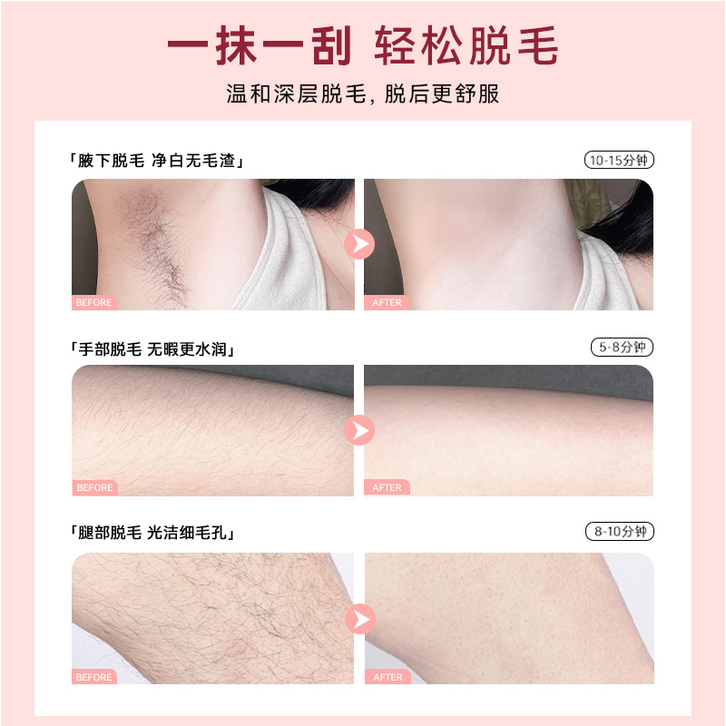 玛贝拉脱毛膏女腋下非私处脱毛唇部男学生专用腋毛腿毛全身不永久