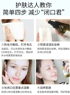 德德维芙马鞭草酮迷迭香闭口粉刺