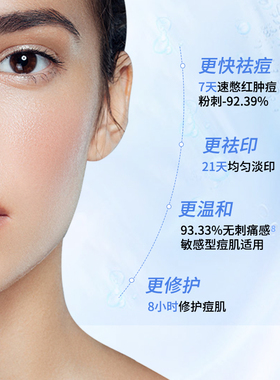 【升级2.0新款】希川科颜馆20%壬二酸精华霜祛痘闭口痘印杨科研