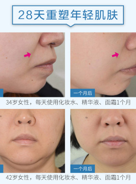 日本MT紧致系列亢皱提拉化妆水乳液精华面霜滋润面膜水乳套装