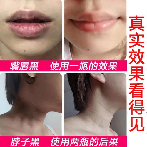 泰国樱花嫩红素正品私处粉嫩紧致乳晕粉嫩天然嘴唇部唇膏紧致乳晕 - 图1