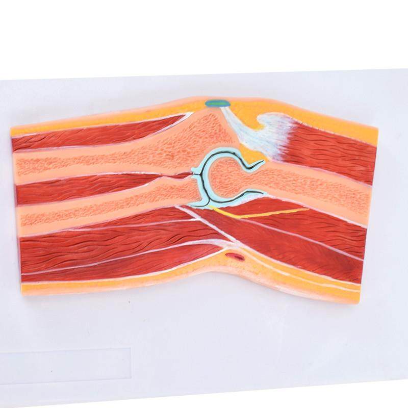 ENOVO颐诺医学解剖肘关节骨骼肌肉模型肘关节剖面肘关节X构造MRI,淘宝优惠券,粉丝福利购,淘宝优惠卷