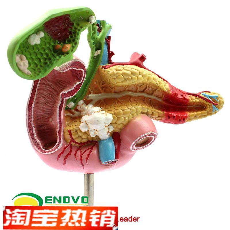 ENOVO颐诺医学胰腺十二指肠胆囊病G理模型外科消化科系统模具肝胆,淘宝优惠券,粉丝福利购,淘宝优惠卷