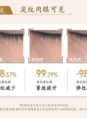 马应龙眼霜眼部精华女补水保湿