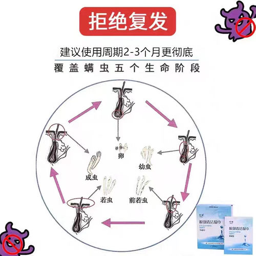 明晞眼部清洁湿巾茶树精油眼贴4-松油醇眼睑清洁眼睛螨虫28片装 - 图1