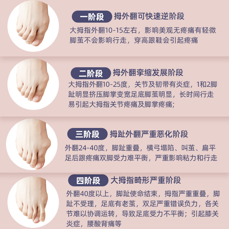 足弓矫正脚部锻炼腿部训练器 klevkids咔啦孩美腿机/腿部训练器
