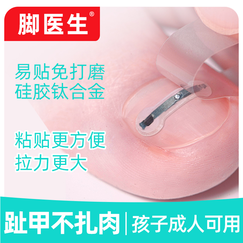 脚医生甲沟嵌甲矫正器炎正甲贴拉拉脚沟卷甲脚趾甲贴指甲长肉里