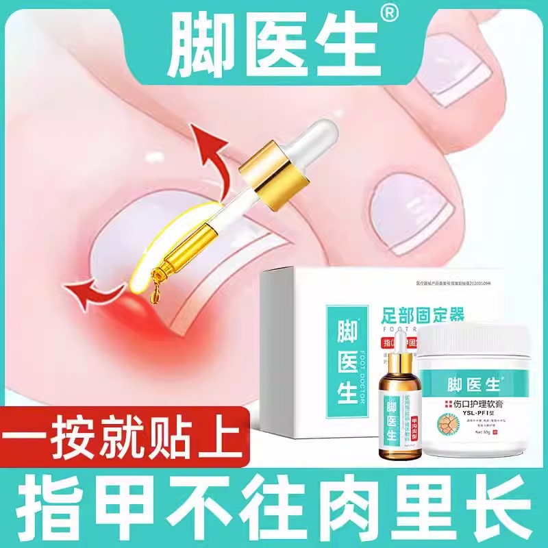 脚医生足部固定器甲沟炎专用软甲消肿去肉芽嵌甲矫正器脚趾正甲贴