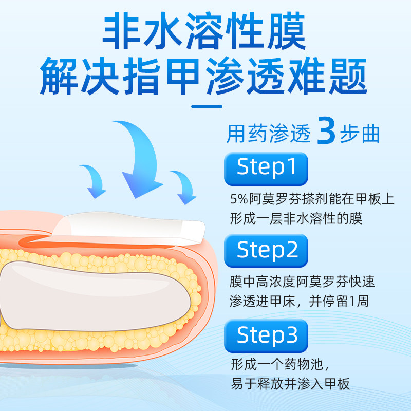  杨四郎药业大药房癣症