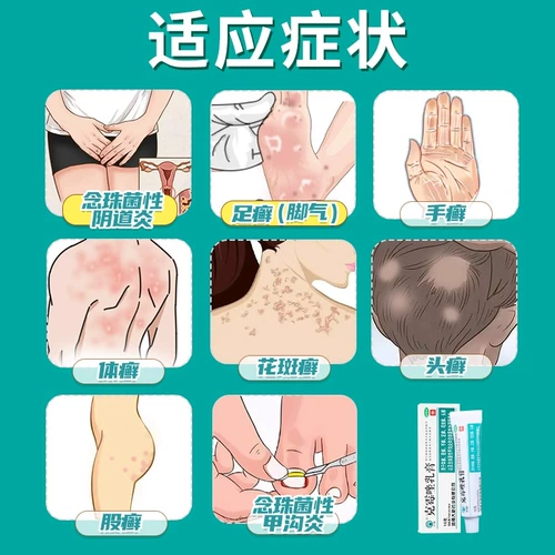 БЕСПЛАТНАЯ ДОСТАВКА] КЛИМАЗОЛ КРИЦА ИНСТРУЗНЕНИЯ частные детали анти-килочки и антибактериальные гинекологические грибковые вагинит