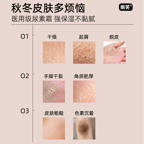 尿素乳膏官方旗舰店正品尿素乳膏正品医用尿素软膏正品脚后跟干裂 - 图0