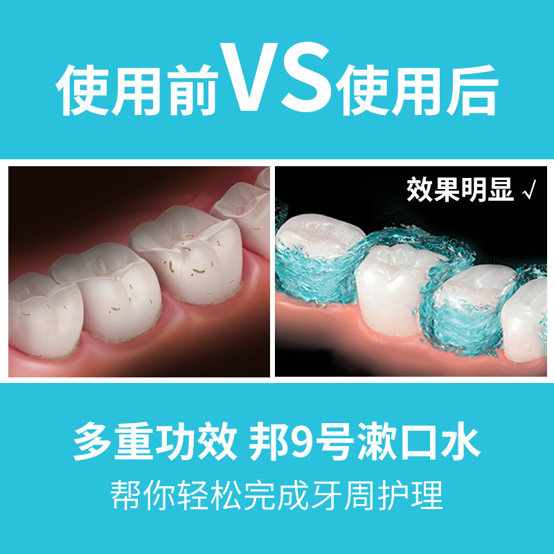  邦9号化妆品漱口水