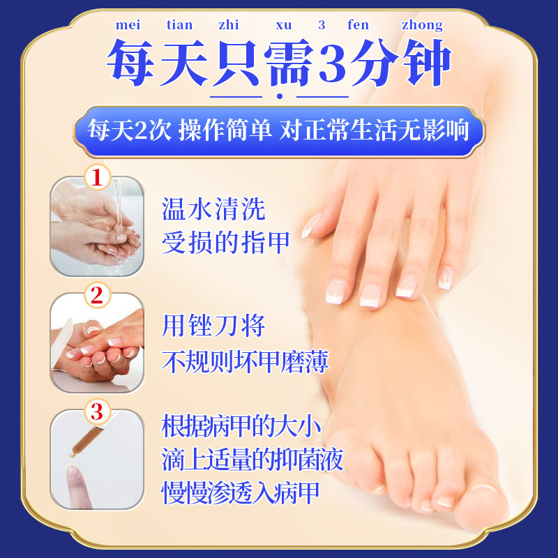 修正灰指甲抑菌液【2送1/3送2】液体 慧欧保健品保健理疗